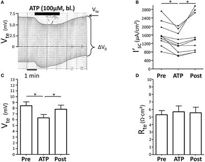 P2X Receptors Inhibit NaCl Absorption in mTAL Independently of Nitric Oxide